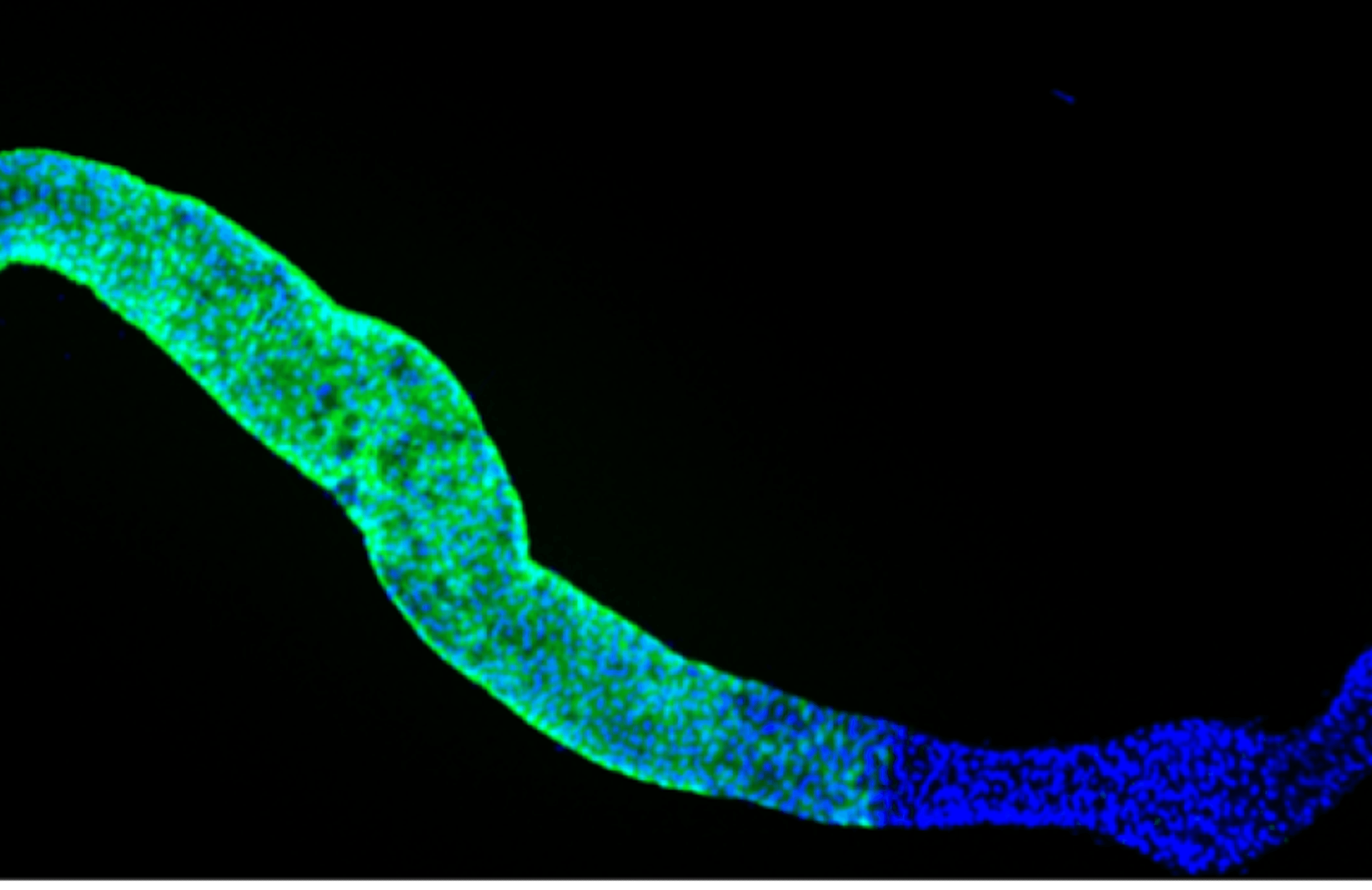 Cells in a fruit fly GI tract glow under a microscope. Image: Afroditi Petsakou